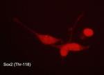 Phospho-SOX2 (Thr118) Antibody in Immunocytochemistry (ICC/IF)