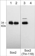 Phospho-SOX2 (Thr118) Antibody in Western Blot (WB)