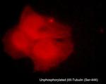 Beta III Tubulin Antibody in Immunocytochemistry (ICC/IF)