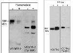 Phospho-VEGF Receptor 2 (Tyr801) Antibody in Western Blot (WB)