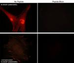 Phospho-N-WASP (Ser484, Ser485) Antibody in Immunocytochemistry (ICC/IF)