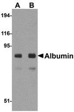 Albumin Antibody in Western Blot (WB)