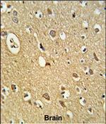 OMD Antibody in Immunohistochemistry (Paraffin) (IHC (P))