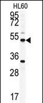 OMD Antibody in Western Blot (WB)