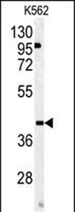 OMD Antibody in Western Blot (WB)