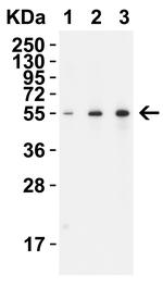 TMPRSS2 Antibody in Western Blot (WB)