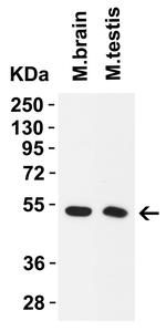 TMPRSS2 Antibody in Western Blot (WB)