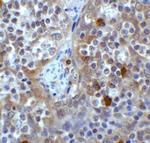 VISTA Antibody in Immunohistochemistry (Paraffin) (IHC (P))