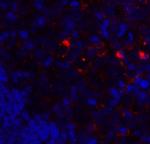 VISTA Antibody in Immunohistochemistry (Paraffin) (IHC (P))