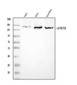 ATP7B Antibody in Western Blot (WB)