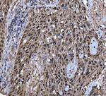 Twist1/Twist2 Antibody in Immunohistochemistry (Paraffin) (IHC (P))