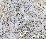 Twist1/Twist2 Antibody in Immunohistochemistry (Paraffin) (IHC (P))