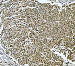 Twist1/Twist2 Antibody in Immunohistochemistry (Paraffin) (IHC (P))