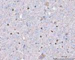 Twist1/Twist2 Antibody in Immunohistochemistry (Paraffin) (IHC (P))