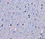 Twist1/Twist2 Antibody in Immunohistochemistry (Paraffin) (IHC (P))