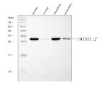 Twist1/Twist2 Antibody in Western Blot (WB)