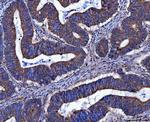 FRY Antibody in Immunohistochemistry (Paraffin) (IHC (P))