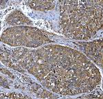 FRY Antibody in Immunohistochemistry (Paraffin) (IHC (P))