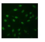 NPR1 Antibody in Immunocytochemistry (ICC/IF)