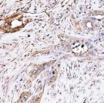 PAK2 Antibody in Immunohistochemistry (Paraffin) (IHC (P))