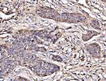 PAK2 Antibody in Immunohistochemistry (Paraffin) (IHC (P))