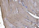 PAK2 Antibody in Immunohistochemistry (Paraffin) (IHC (P))