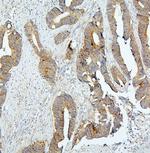 BUBR1 Antibody in Immunohistochemistry (Paraffin) (IHC (P))