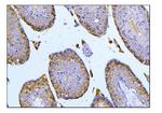 BUBR1 Antibody in Immunohistochemistry (Paraffin) (IHC (P))