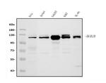 BUBR1 Antibody in Western Blot (WB)