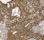 MTTP Antibody in Immunohistochemistry (Paraffin) (IHC (P))