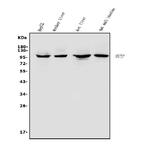 MTTP Antibody in Western Blot (WB)