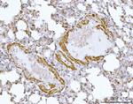 HBEGF Antibody in Immunohistochemistry (Paraffin) (IHC (P))