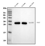 TIGIT Antibody in Western Blot (WB)