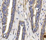 GLUT9 Antibody in Immunohistochemistry (Paraffin) (IHC (P))