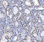 MBNL1 Antibody in Immunohistochemistry (Paraffin) (IHC (P))