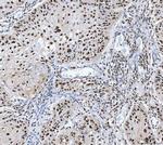 MBNL1 Antibody in Immunohistochemistry (Paraffin) (IHC (P))