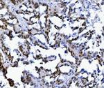 MBNL1 Antibody in Immunohistochemistry (Paraffin) (IHC (P))