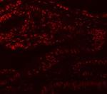 MBNL1 Antibody in Immunohistochemistry (Paraffin) (IHC (P))