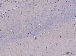 GNB3 Antibody in Immunohistochemistry (Paraffin) (IHC (P))