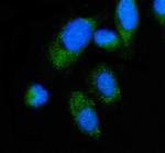 ALAS2 Antibody in Immunocytochemistry (ICC/IF)