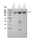 CaV1.1 Antibody in Western Blot (WB)