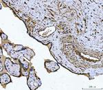 TPM2 Antibody in Immunohistochemistry (Paraffin) (IHC (P))