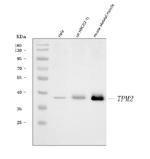 TPM2 Antibody in Western Blot (WB)