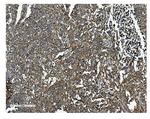 Clathrin Heavy Chain Antibody in Immunohistochemistry (Paraffin) (IHC (P))