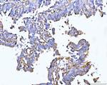 COL6A2 Antibody in Immunohistochemistry (Paraffin) (IHC (P))