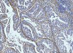 COL6A2 Antibody in Immunohistochemistry (Paraffin) (IHC (P))