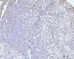 COL6A2 Antibody in Immunohistochemistry (Paraffin) (IHC (P))