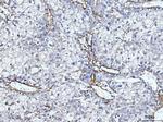 COL6A2 Antibody in Immunohistochemistry (Paraffin) (IHC (P))