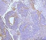 COL6A2 Antibody in Immunohistochemistry (Paraffin) (IHC (P))