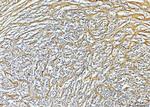 COL6A2 Antibody in Immunohistochemistry (Paraffin) (IHC (P))